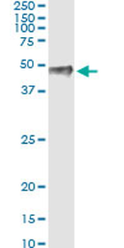 PITX1 monoclonal antibody (M01), clone 5G4