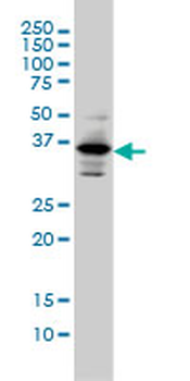 PITX1 monoclonal antibody (M01), clone 5G4