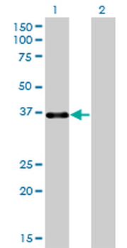 PITX1 monoclonal antibody (M01), clone 5G4