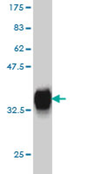 PITX1 monoclonal antibody (M01), clone 5G4