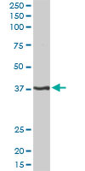 PITX1 purified MaxPab rabbit polyclonal antibody (D01P)