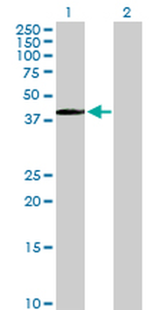 PITX1 purified MaxPab rabbit polyclonal antibody (D01P)