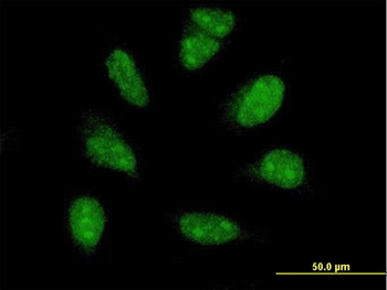 PIM1 monoclonal antibody (M08), clone 1C10