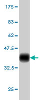 PIM1 monoclonal antibody (M08), clone 1C10