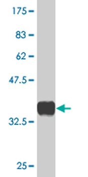 PHF1 monoclonal antibody (M01), clone 2D3