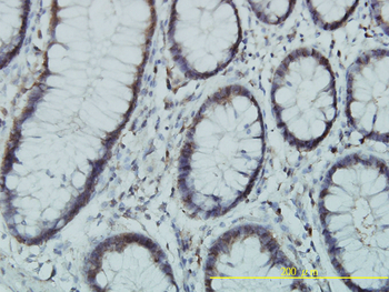 PGM3 monoclonal antibody (M01), clone 1E2-1B12