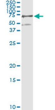 PGM3 monoclonal antibody (M01), clone 1E2-1B12