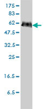 PGM3 monoclonal antibody (M01), clone 1E2-1B12