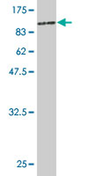 PGM3 monoclonal antibody (M01), clone 1E2-1B12