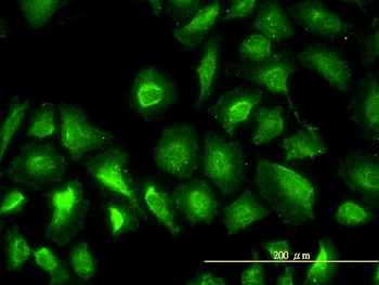 PGM1 monoclonal antibody (M01), clone 3B8-H4