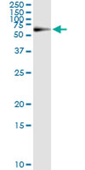 PGM1 monoclonal antibody (M01), clone 3B8-H4