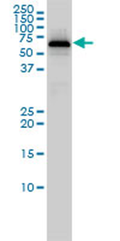 PGM1 monoclonal antibody (M01), clone 3B8-H4