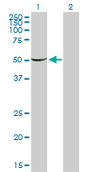 PGM1 monoclonal antibody (M01), clone 3B8-H4