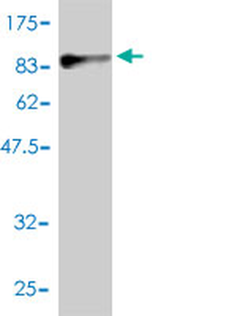PGM1 monoclonal antibody (M01), clone 3B8-H4