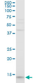 PFN1 polyclonal antibody (A01)
