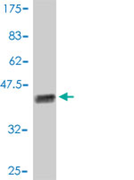 PFN1 polyclonal antibody (A01)