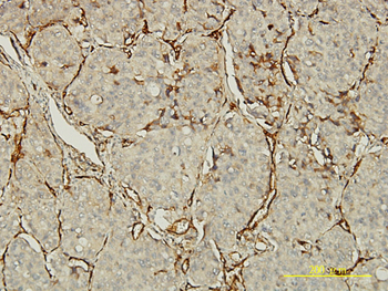 PECAM1 monoclonal antibody (M01), clone 1D2-1A5
