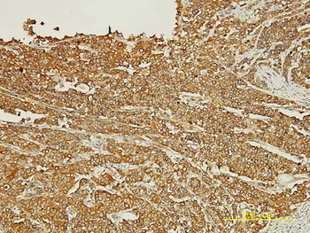 PDZK1 monoclonal antibody (M01), clone 1C3-2B11