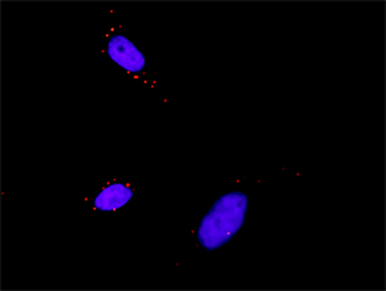 PDPK1 purified MaxPab mouse polyclonal antibody (B01P)