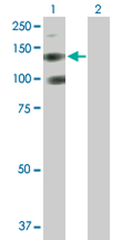 PDGFRA purified MaxPab rabbit polyclonal antibody (D01P)