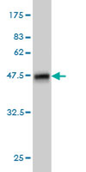 PDE1B monoclonal antibody (M01), clone 5B6