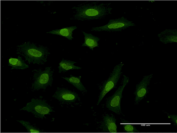 PDE3A monoclonal antibody (M03), clone 2D7