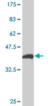 PDE3A monoclonal antibody (M03), clone 2D7
