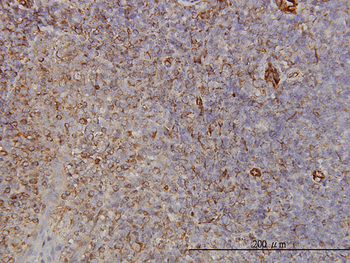 PCDH8 monoclonal antibody (M01), clone 6A8