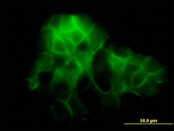 PCDH1 monoclonal antibody (M01), clone 5D5