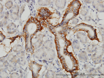 PCDH1 monoclonal antibody (M01), clone 5D5