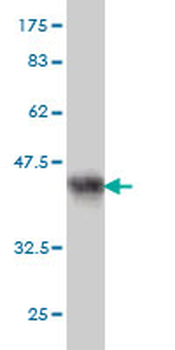 PCDH1 monoclonal antibody (M01), clone 5D5