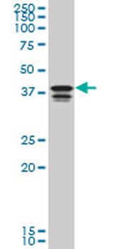PCBP2 monoclonal antibody (M08), clone 6E9