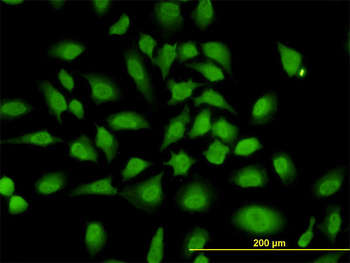 PCBP2 monoclonal antibody (M07), clone 5F12