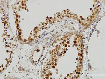 PCBP2 monoclonal antibody (M07), clone 5F12