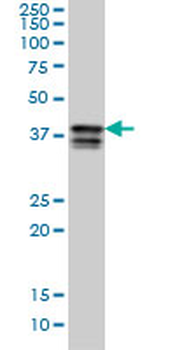PCBP2 monoclonal antibody (M07), clone 5F12