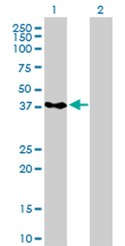 PCBP2 monoclonal antibody (M07), clone 5F12