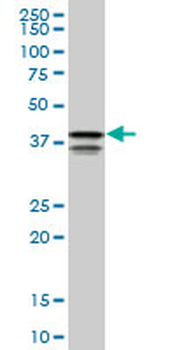 PCBP2 monoclonal antibody (M05), clone 1C7