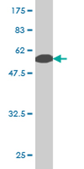 PCBP2 monoclonal antibody (M05), clone 1C7