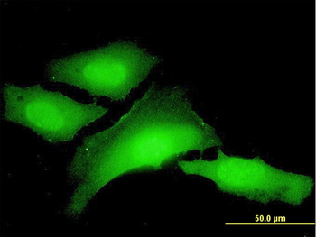 PCBP1 monoclonal antibody (M01), clone 1G2