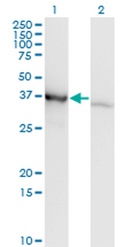 PCBP1 monoclonal antibody (M01), clone 1G2