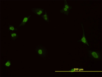 PBX1 monoclonal antibody (M01), clone 4A2