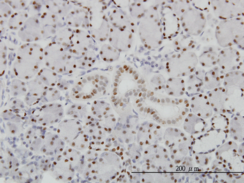 PBX1 monoclonal antibody (M01), clone 4A2