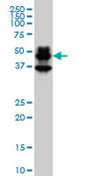 PBX1 monoclonal antibody (M01), clone 4A2