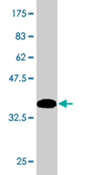PBX1 monoclonal antibody (M01), clone 4A2