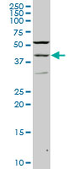 PAX2 monoclonal antibody (M02), clone 2E4