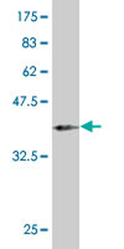 PAX2 monoclonal antibody (M02), clone 2E4