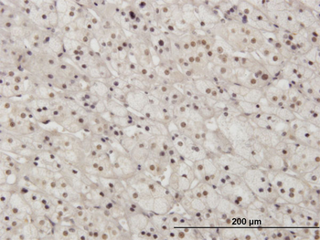 PAX2 monoclonal antibody (M01), clone 3C7
