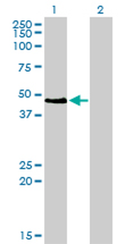 PAX2 monoclonal antibody (M01), clone 3C7