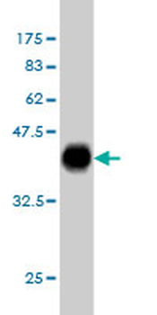 PAX2 monoclonal antibody (M01), clone 3C7
