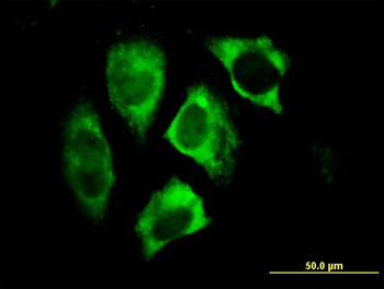 PARK2 monoclonal antibody (M01), clone 1H4